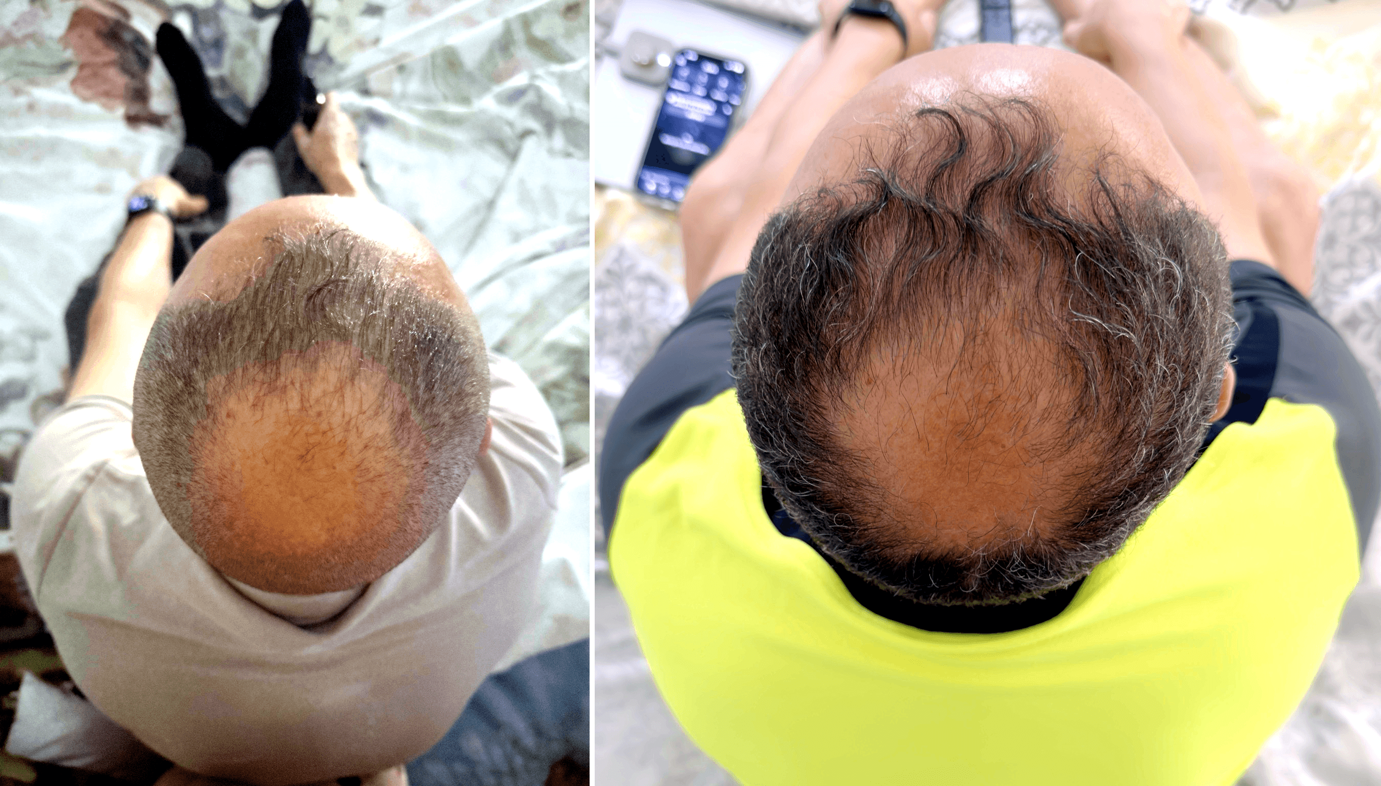 Crown comparison, submitted before-and-after comparison