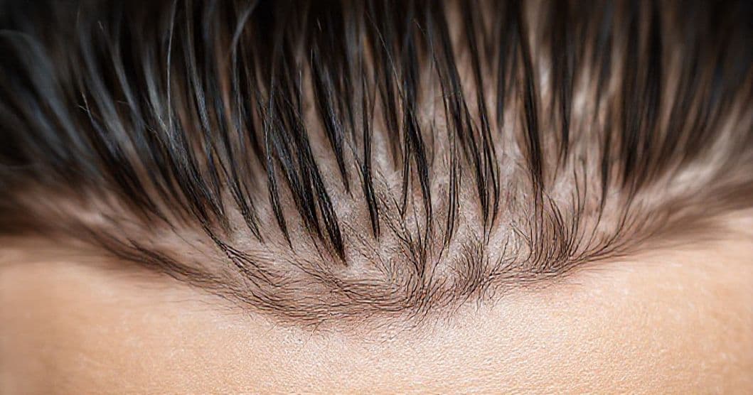 Calm, confident person examining thinning hair in West Coast USA