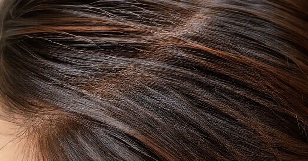 Close-up of healthy, healthy-looking hair on a scalp
